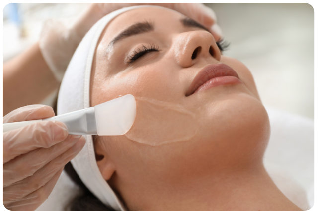 Peeling buenos aires argetnina terssa ofertas de peeling facial